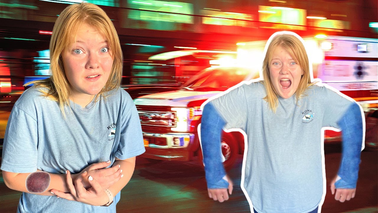 I BROKE My ARM!