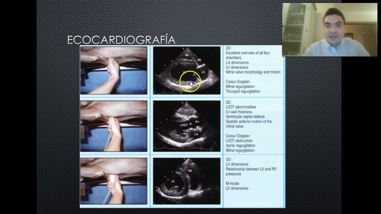 Ecocardio parte 1