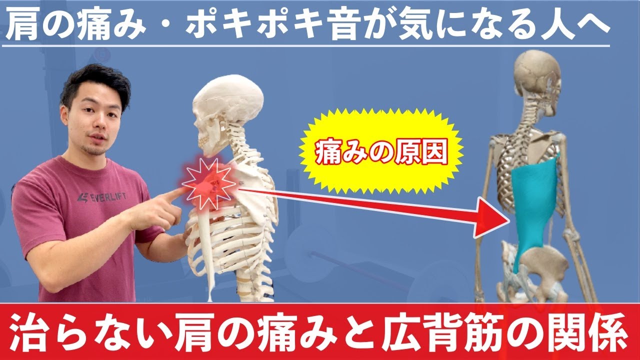 【ショルダープレス】肩の痛みが長引く原因「広背筋症候群」と改善方法