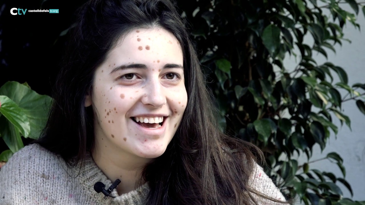 'FAN' Castelldefels - T3 E5 Alba Parejo, influencer i pacient de malaltia minorit&agrave;ria