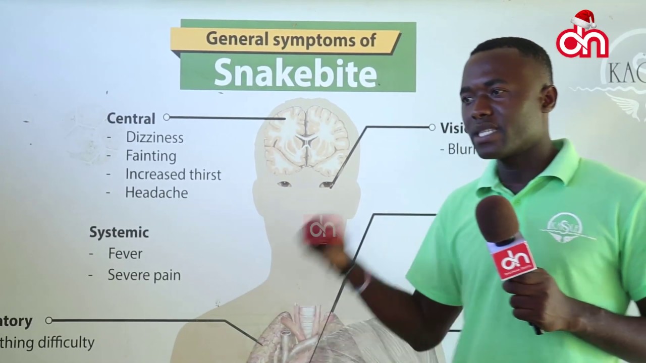 Fahamu sumu za nyoka na namna zinavyoathiri mwili wa binadamu