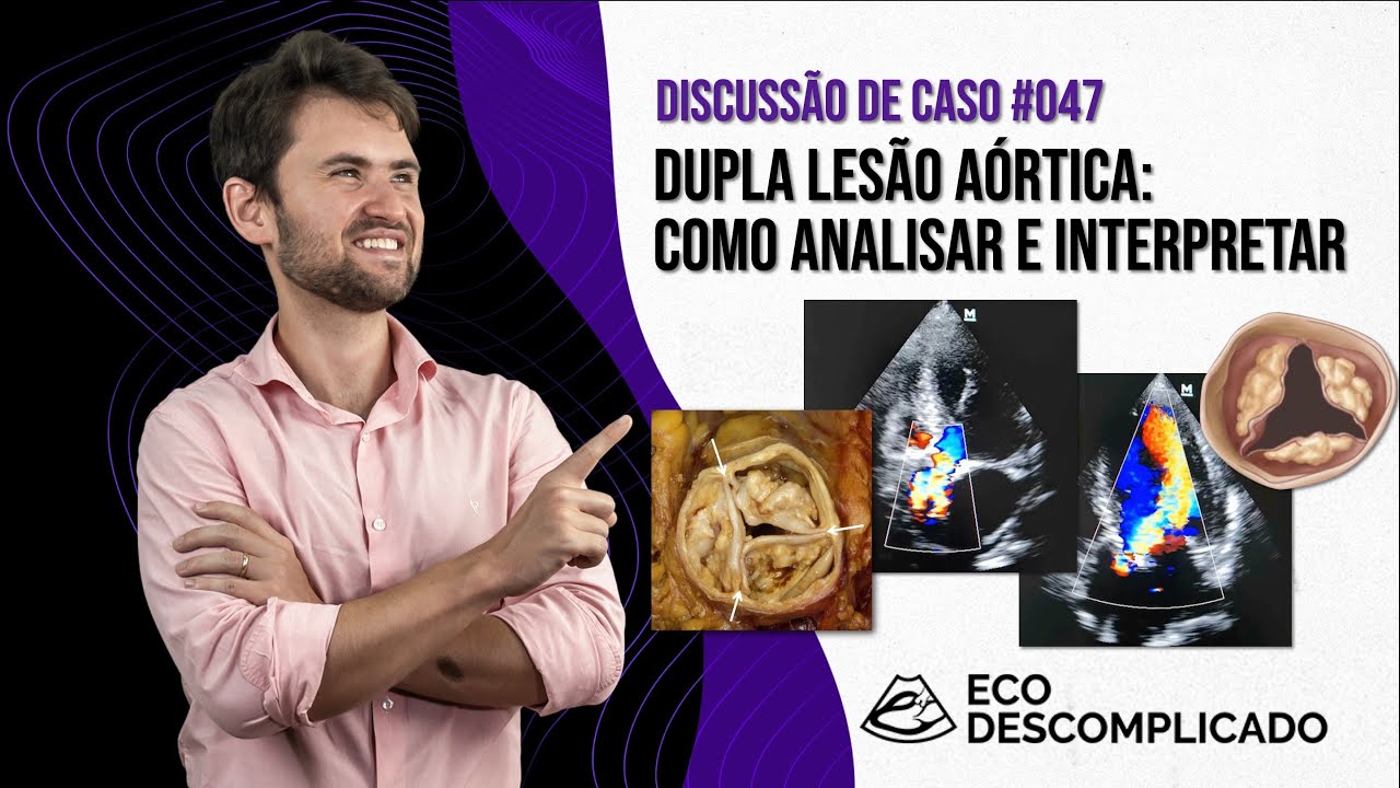 EcoDescomplicado - Discussão de caso #047 - Como analisar e interpretar uma Dupla Lesão Aórtica
