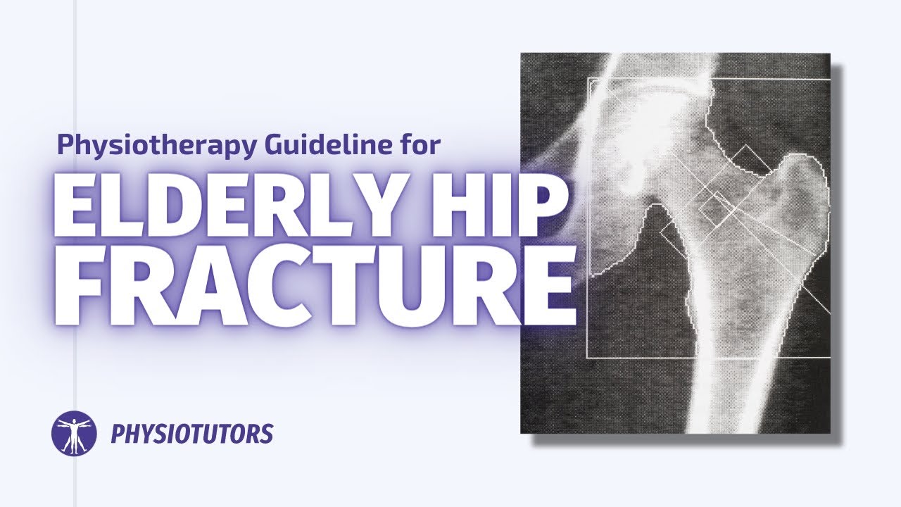 How to treat hip fractures in the elderly | Physiotherapy Guideline Review