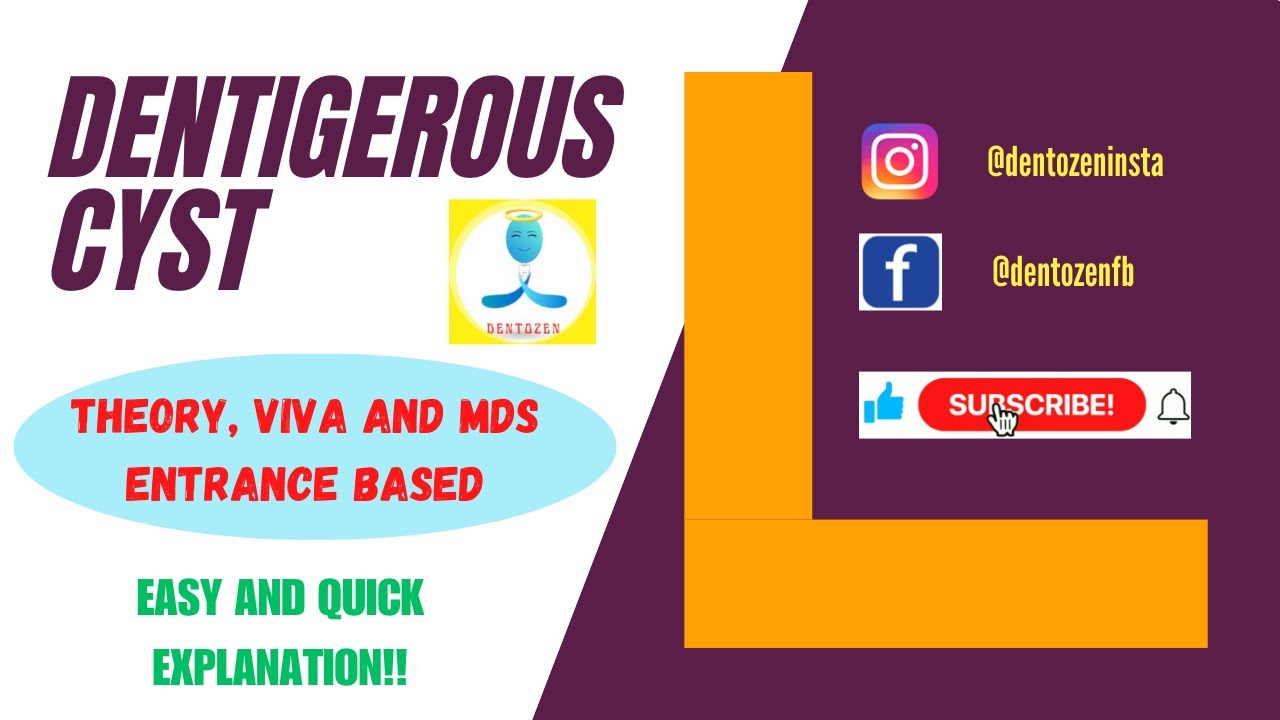 Одонтогенная киста: что нужно о ней знать?