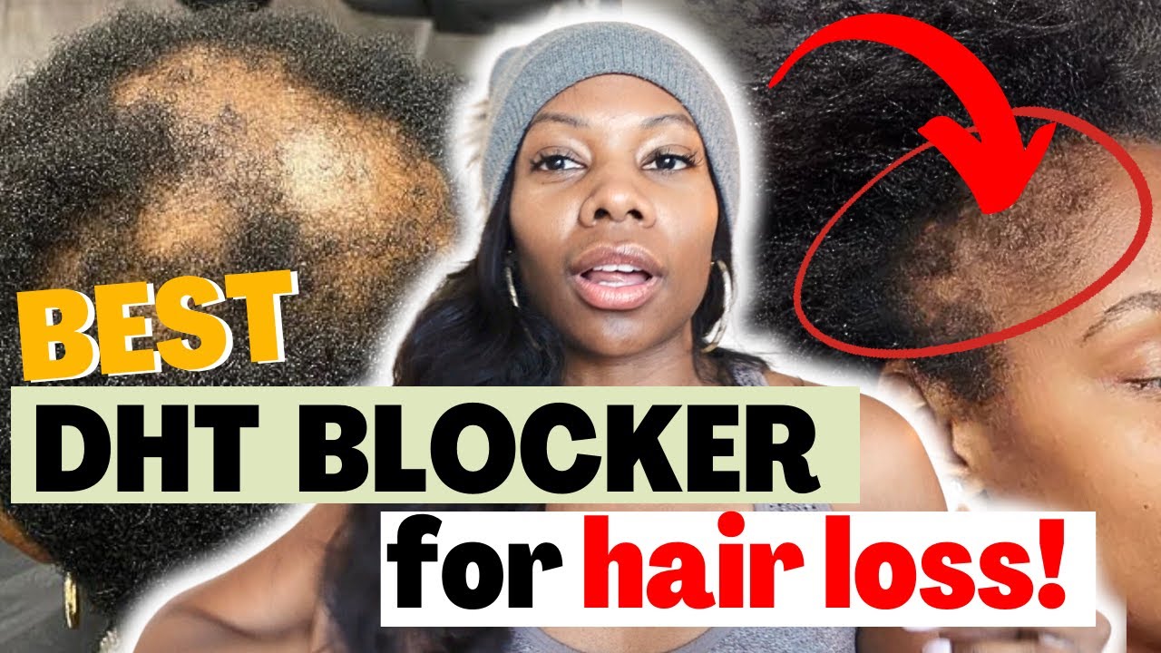 DHT Blockers for Hair Growth: Understanding The Hype and The Science!