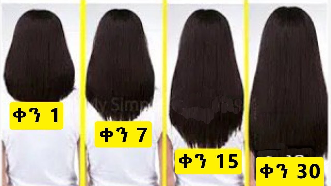 Ethiopia | ፀጉርን በአንድ ወር ውስጥ ማሳደጊያ መንገድ