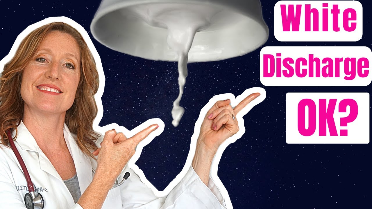 Is it normal to have white vaginal discharge?