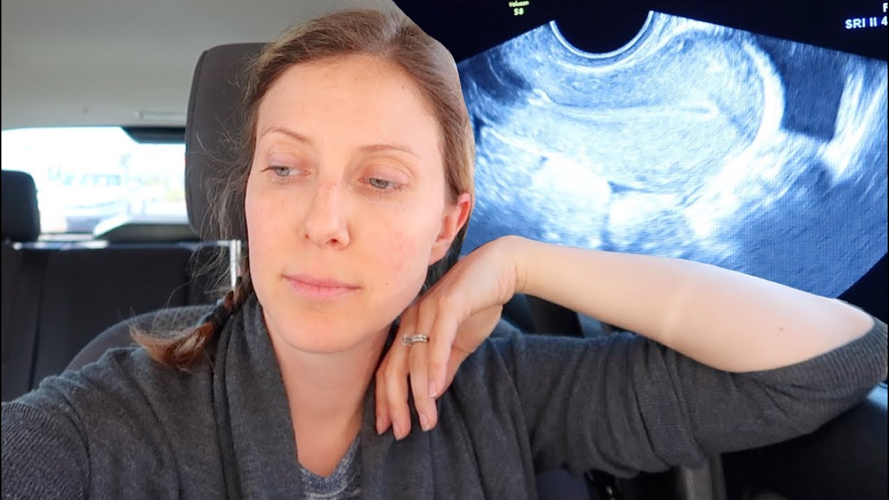 AFTER MISCARRIAGE ULTRASOUND