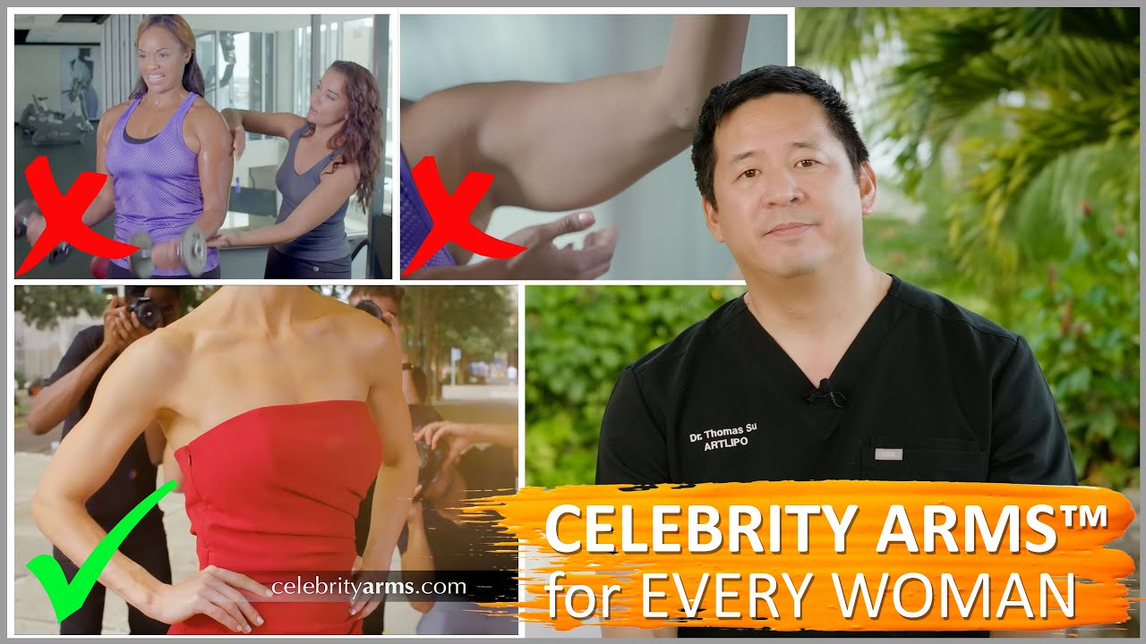 Arm Liposuction | Celebrity Arms&trade;| Lipo 360&deg; Arms Immediate Results | Artlipo | Expert Dr.Thomas  Su
