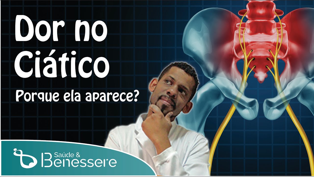 Dor no nervo ci&aacute;tico &ndash; Porque ela aparece?