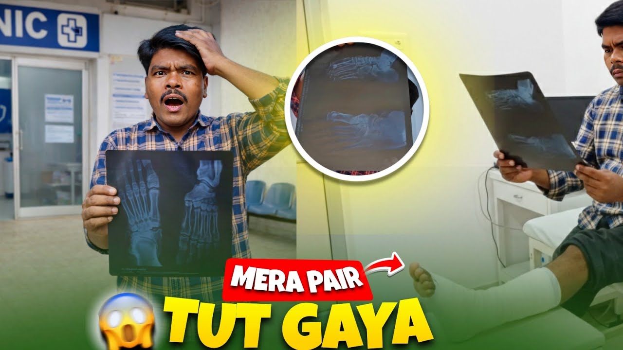 Mera Pair Tut Gaya | Kya Ab Main Kabhi Bhi Gadi Nahi Chala Paunga😭? | Pair Ka X-ray Kara Liya😱#viral
