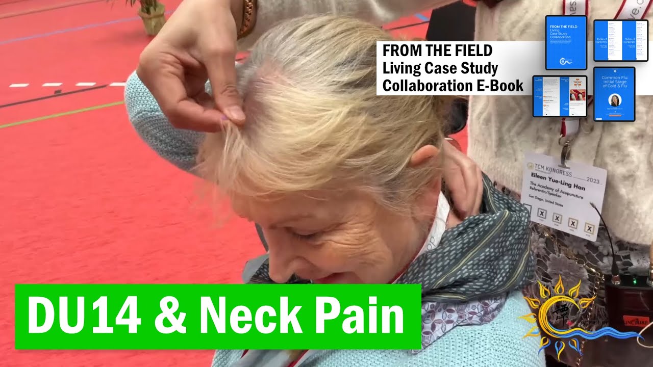 DU14 大椎 Neck Pain #譚針 #eileenhan #韓玉齡 #balancemethodacupuncture #Du14 #theacademyofacupuncture