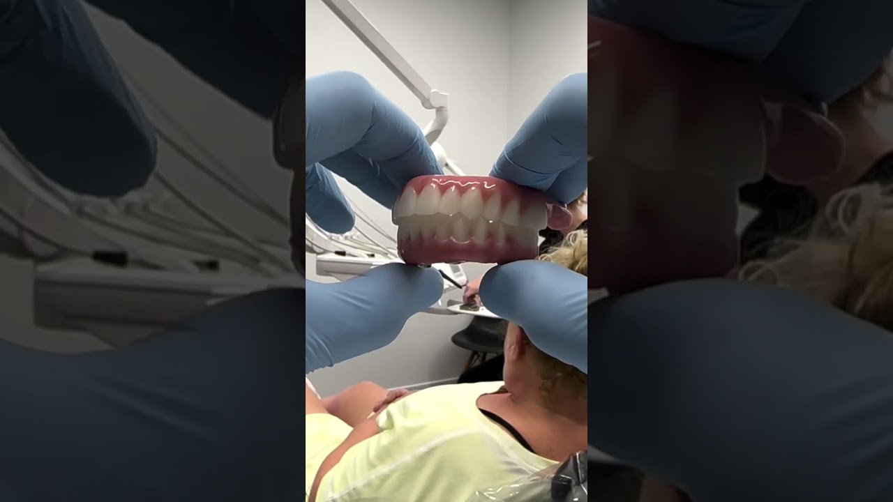 24 hour smile makeover #denturegang #newsmile #dentist #dentalimplants #northcarolina #oralsurgery