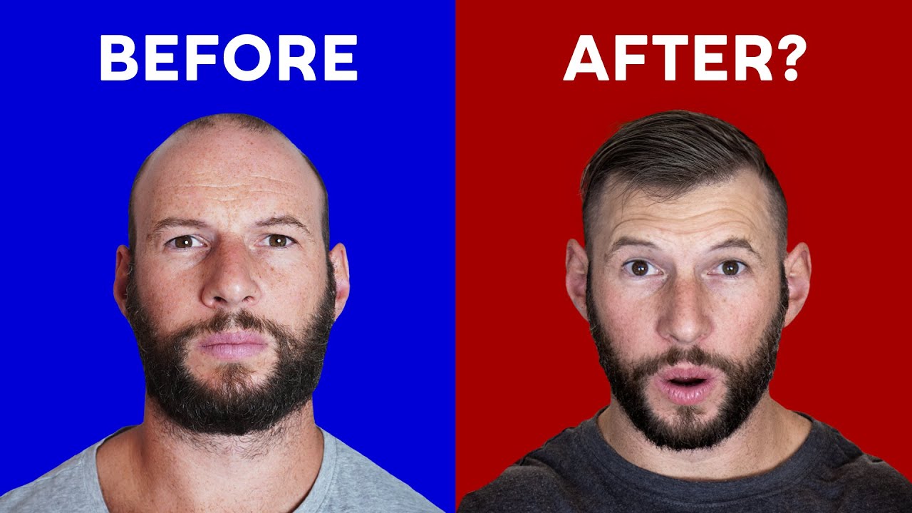 Currentbody Hair Regrowth: Before & After SURPISE?!