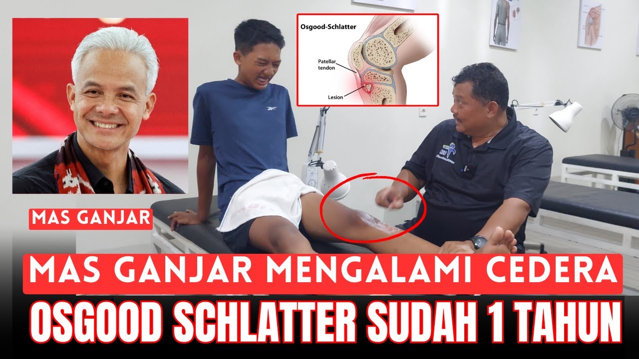 MCO ARIF - MAS GANJAR MENGALAMI CEDERA OSGOOD SCHLATTER SUDAH 1 TAHUN