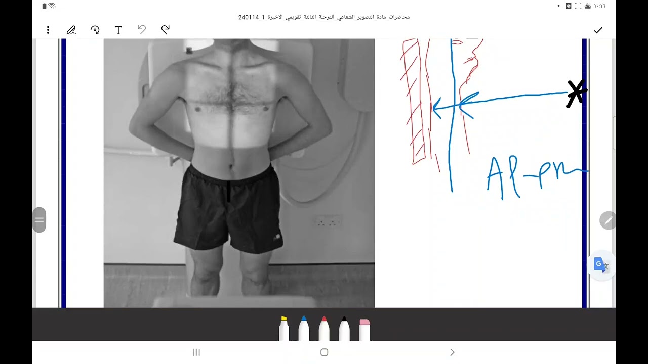 تصوير الصدر جزء ثالثة 