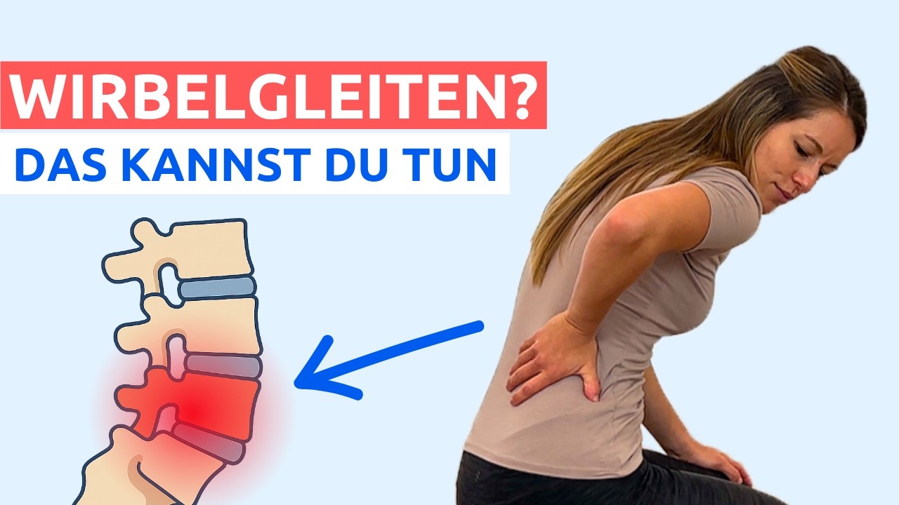 3 EINFACHE Übungen bei Spondylolisthesis (Wirbelgleiten)