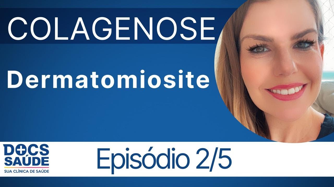O que é dermatomiosite