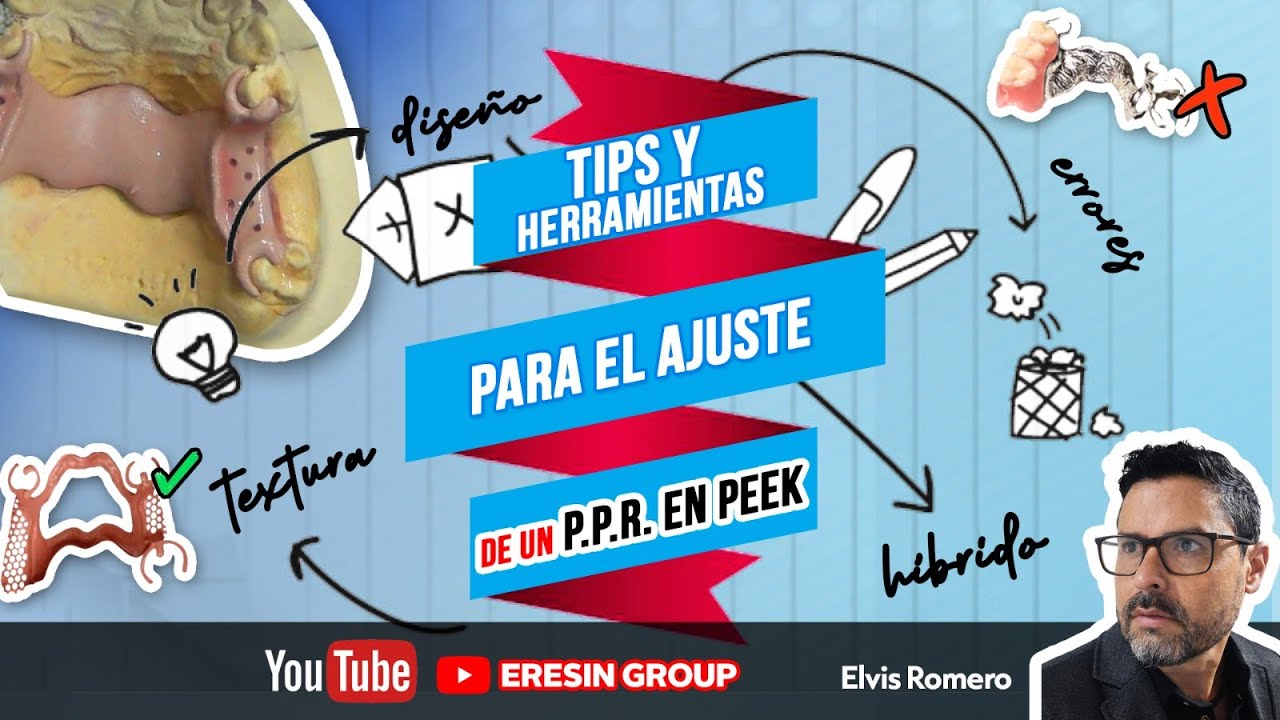 HERRAMIENTAS Y TIPS DE AJUSTE EN UNA ESTRUCTURA CON DOIN PEEK