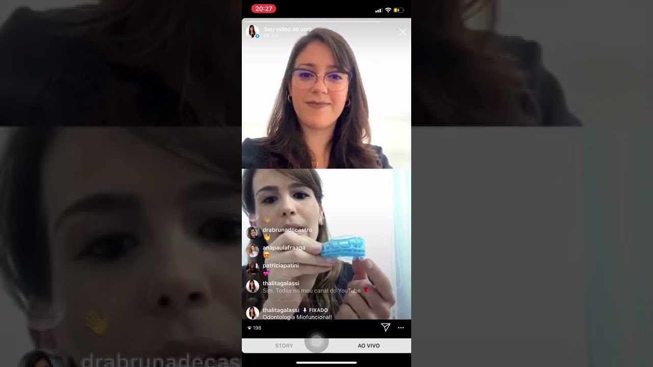 APARELHOS MYOBRACE PRÉ-FABRICADOS – ODONTOLOGIA MIOFUNCIONAL