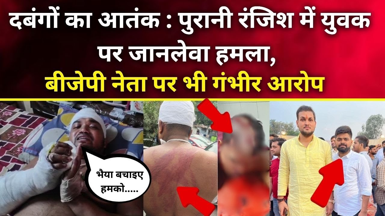 Kanpur : दबंगों का आतंक, पुरानी रंजिश में युवक पर जानलेवा हमला BJP नेता पर भी गंभीर आरोप | uppolice