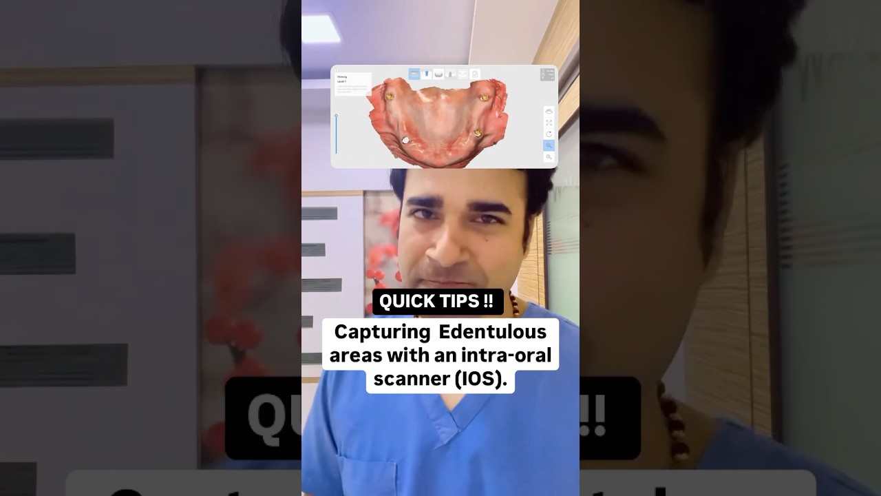 Scan Edentulous Ridges Like a Pro! 🦷📸 | #dentalshorts #dentaleducation #dentaltips #shortsindia