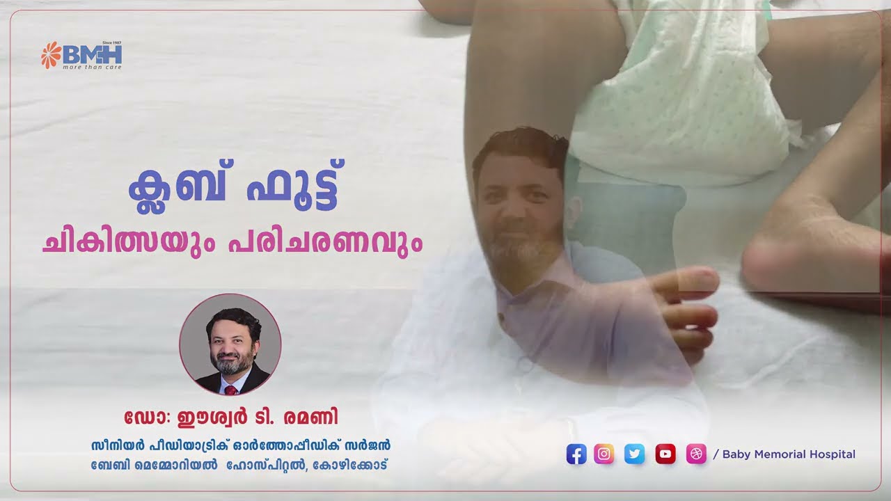 ക്ലബ് ഫൂട്ട് - ചികിത്സയും പരിചരണവും | Dr. Easwar T Ramani