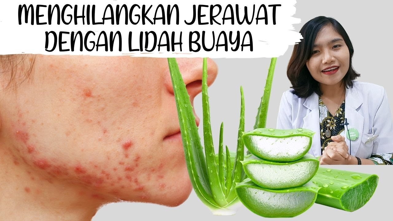 DIY Aloe Vera untuk Jerawat - Cara Pakai Lidah Buaya dirumah  | dr. Emasuperr