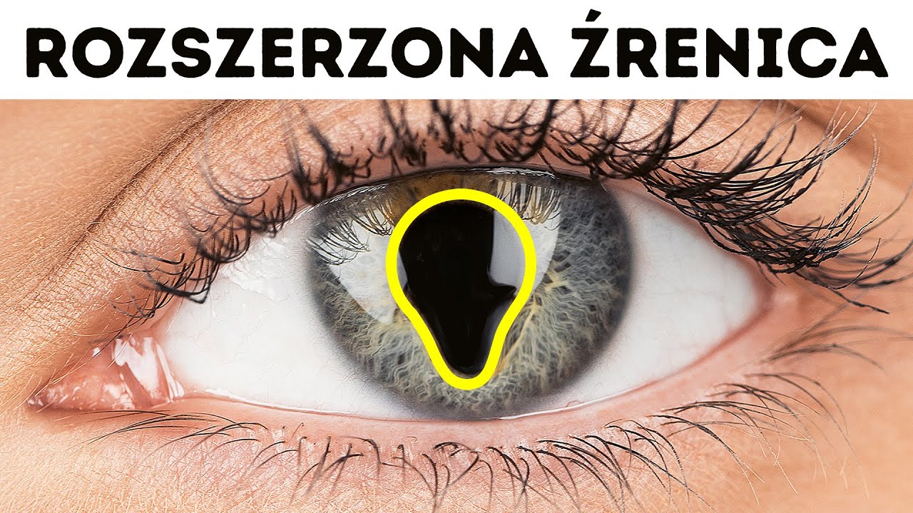 30+ niezwykłych cech ciała, które posiadają tylko nieliczni