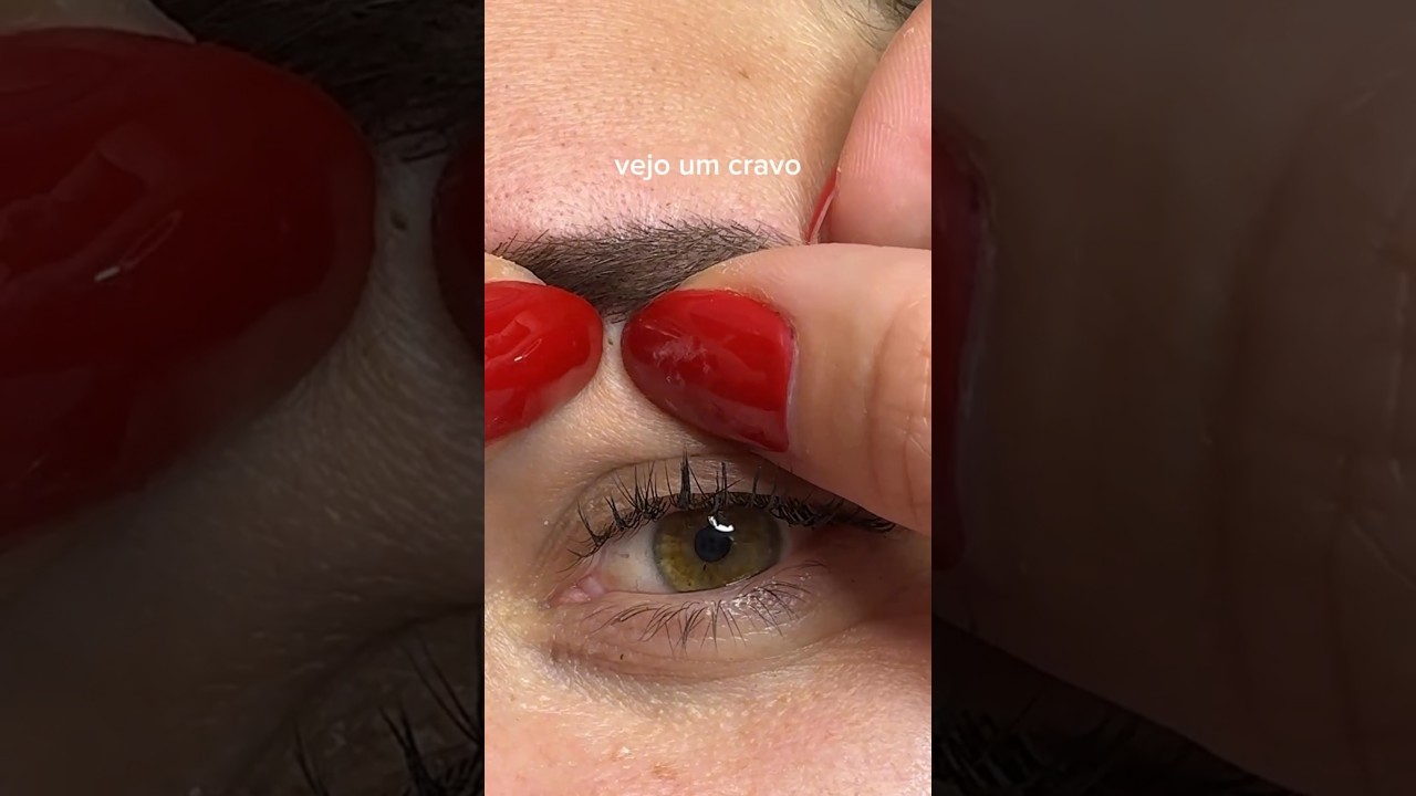 😁 #cravos #cravoseespinhas #limpezadepele #micropigmenta&ccedil;&atilde;o  #lastashes #shortsvideo #shortvideo