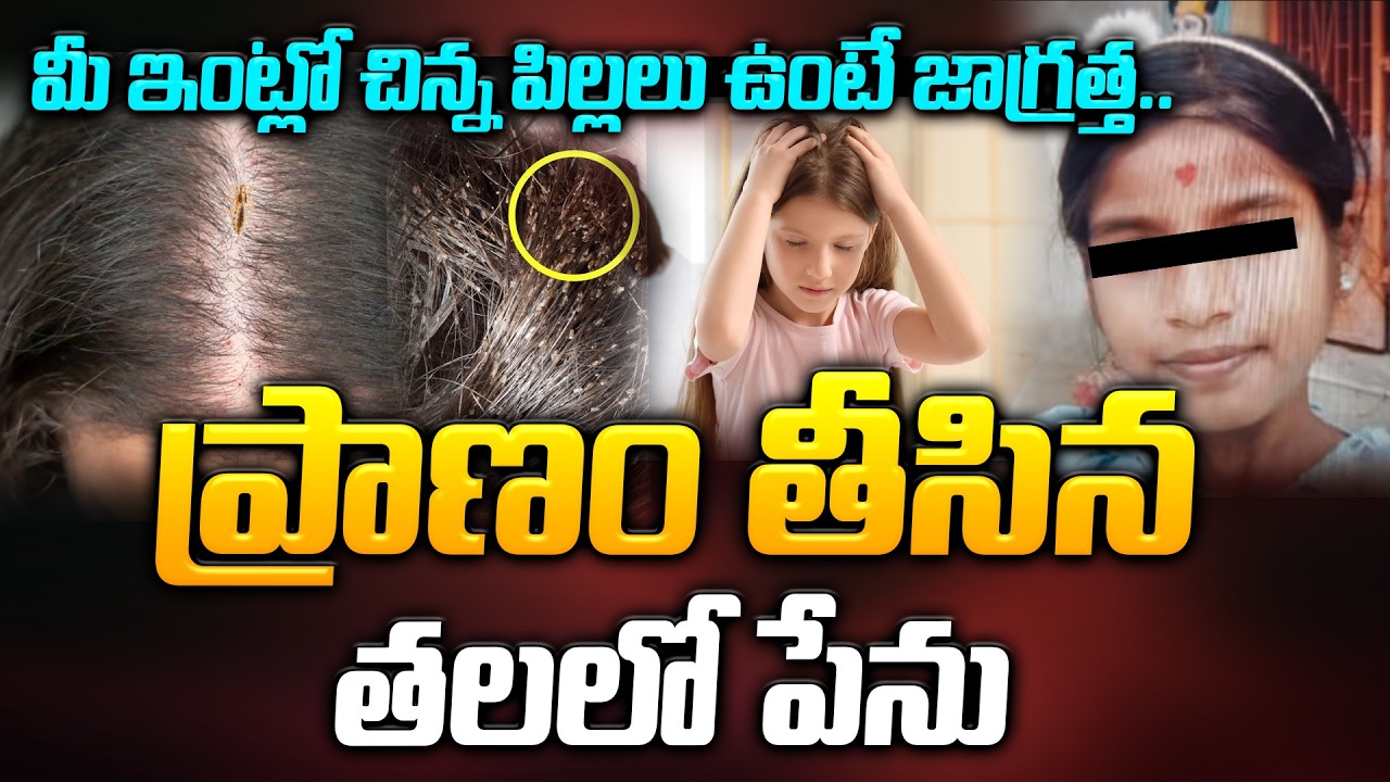 మీ ఇంట్లో చిన్న పిల్లలు ఉంటే జాగ్రత్త.. Head Lice Infestation | Odissa Latest News | Manamtv World