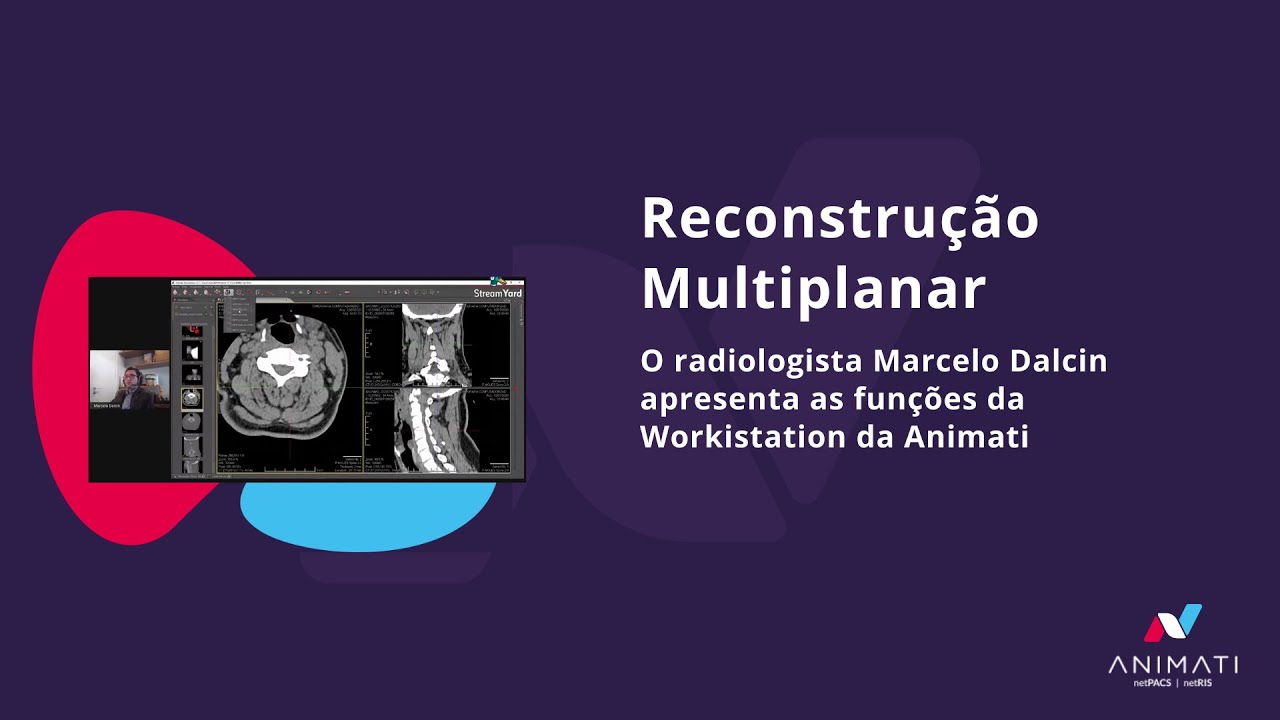 Animati Workstation - Reconstru&ccedil;&atilde;o Multiplanar