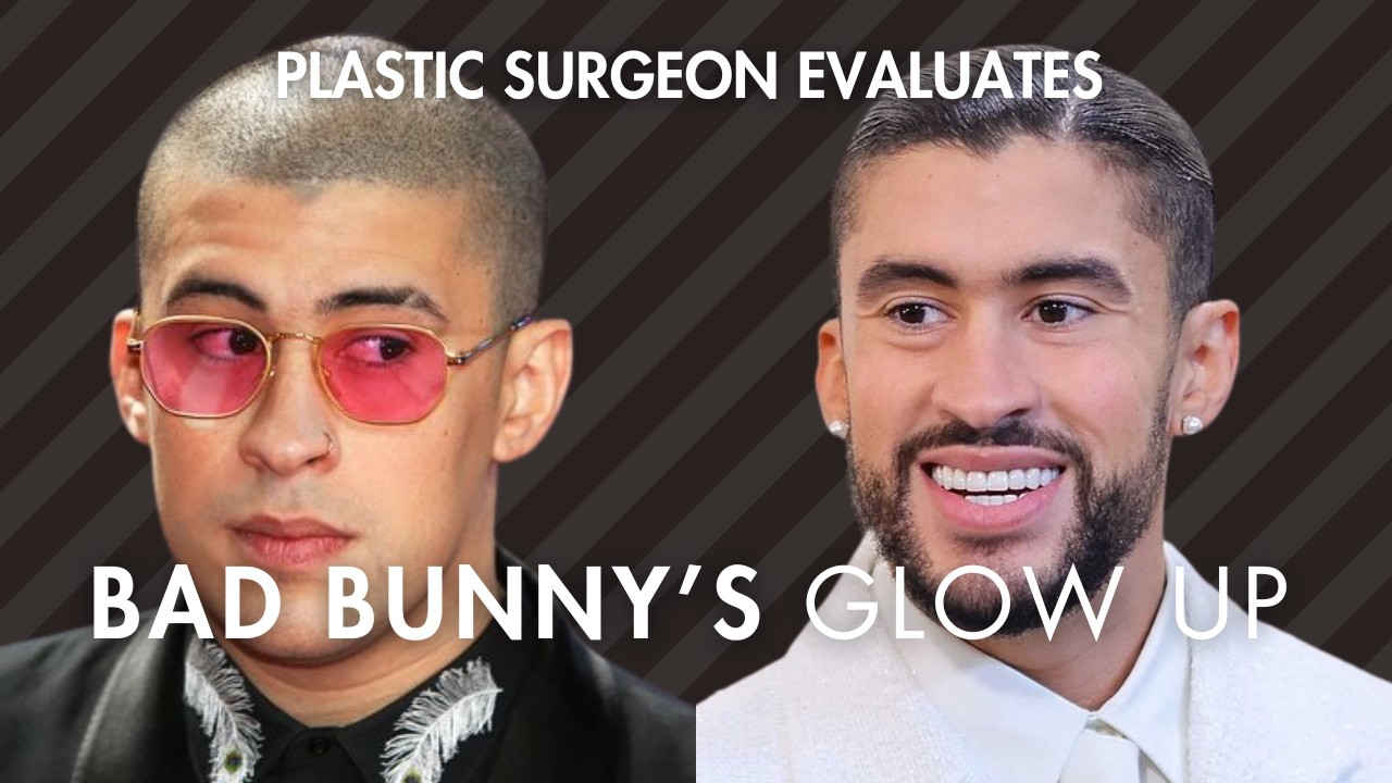 Делал ли Bad Bunny пластическую операцию? Фото до и после + анализ работы пластического хирурга.