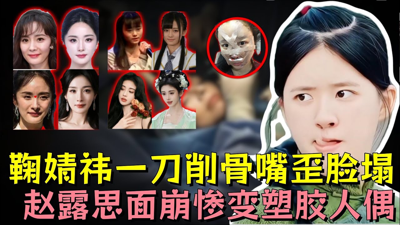 女星一刀削骨翻车太过惊悚，赵露思面崩惨变塑胶人偶，鞠婧祎修修补补嘴歪脸塌，杨紫、杨幂、沈梦辰、金晨、angelababy全部中招#赵露思 #鞠婧祎 #杨幂 #明星 #熱門 ##娱乐评论大赏 #娱乐圈