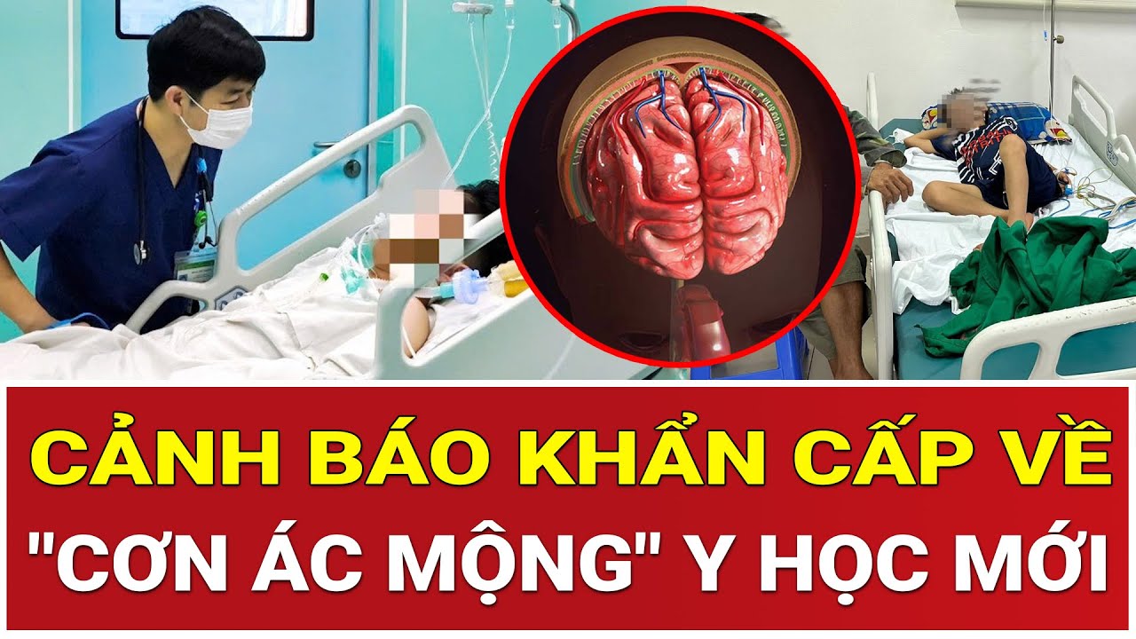 Chỉ vài giờ từ đau đầu đến tử vong: Cảnh báo khẩn cấp về 