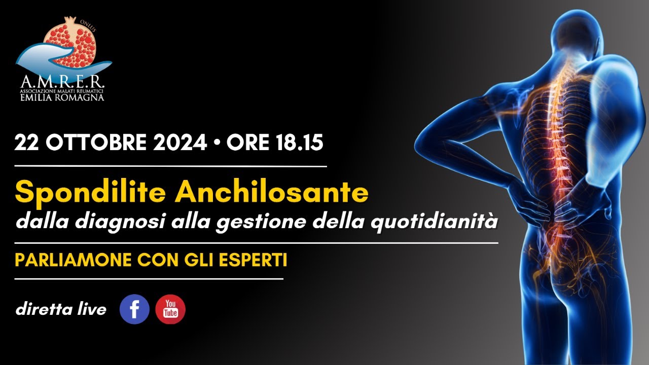 SPONDILITE ANCHILOSANTE diagnosi, terapie, quotidianità