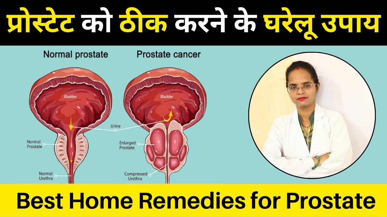 प्रोस्टेट को ठीक करने के घरेलू उपाय | Best Home Remedies for Prostate | Pooja Banjara