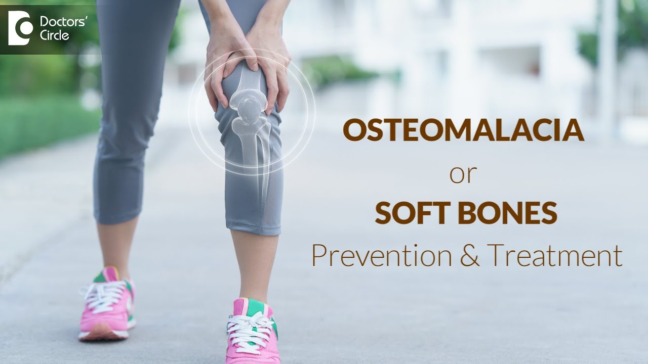 SOFT BONES or OSTEOMALACIA: Vitamin D Deficiency and Bone Pain - Dr. Vinay R | Doctors' Circle