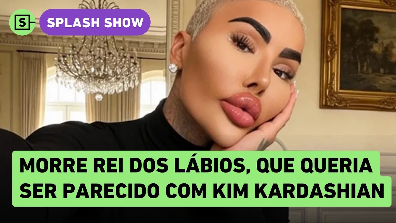 Jordan James Parke é encontrado morto; Rei dos Lábios queria ficar parecido com Kim Kardashian