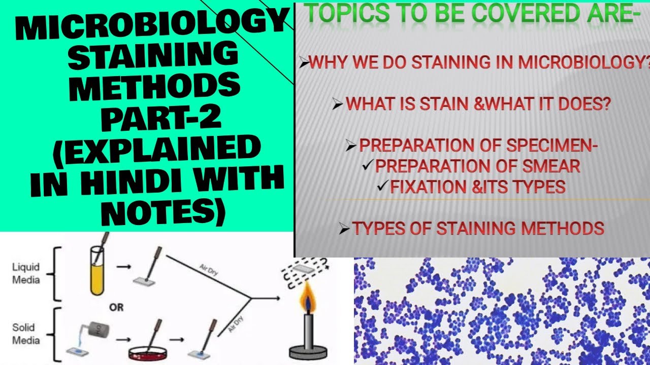 WHY WE DO STAINING |TYPES OF STAINING METHODS|FIXATION TYPES|SMEAR |EXPLAINED IN HINDI WITH NOTES