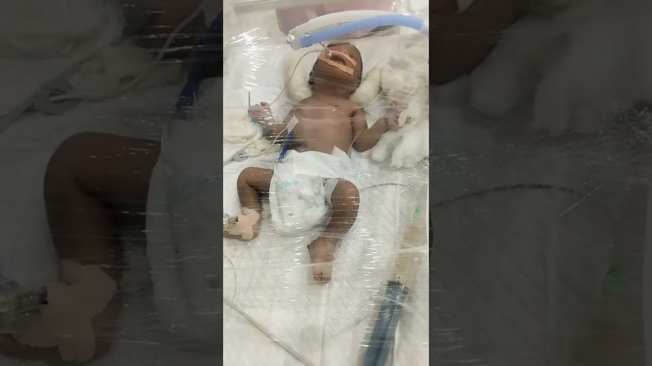 New born baby on ventilator support 🫁🩺!