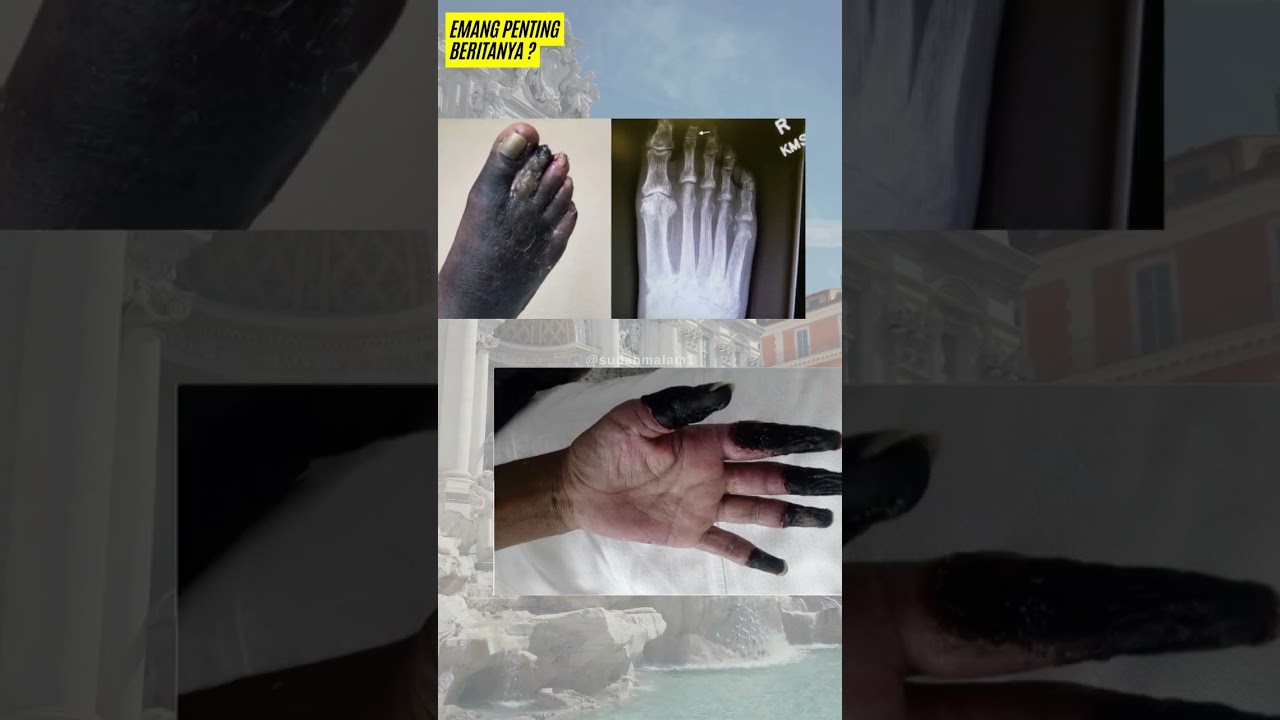 rahasia di balik topeng mengerikan | wabah black death #faktaunik #penyakit #shorts