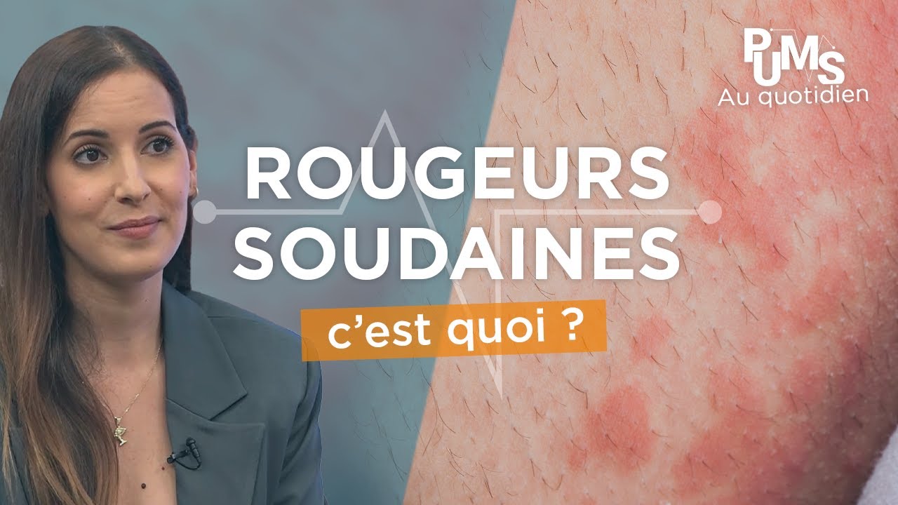 Il faut absolument connaître cette REACTION de votre CORPS, surtout si vous mangez du POISSON  !