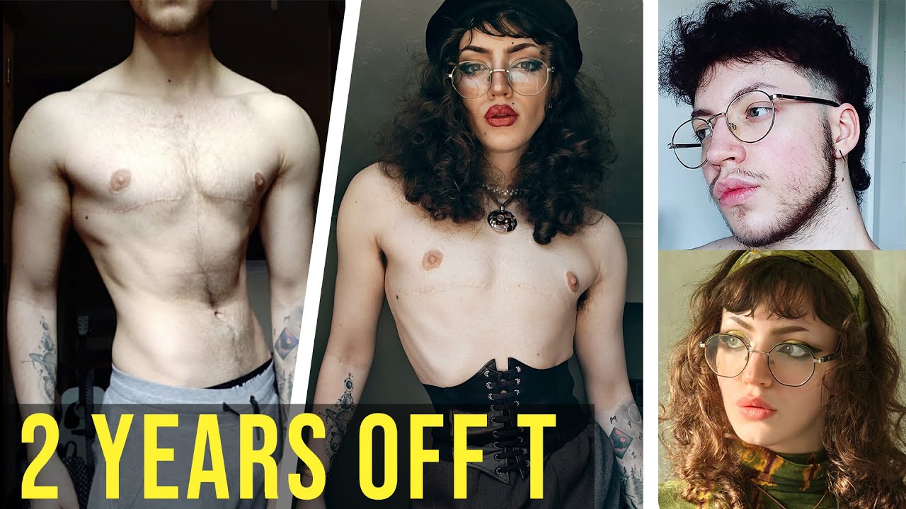 2 YEARS OFF TESTOSTERONE - Can I Still Grow Facial Hair???
