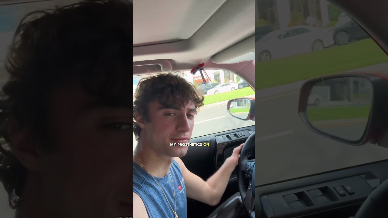 Can I drive as an amputee?