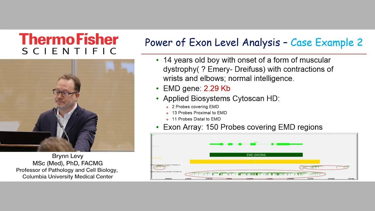 Exon level CNV Analysis in Fetuses with Structural Anomalies