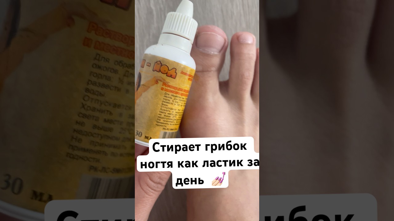 Стирает грибок ногтя как ластик за день 💅🏻 #огород #рецепты #лайфхаки #советы