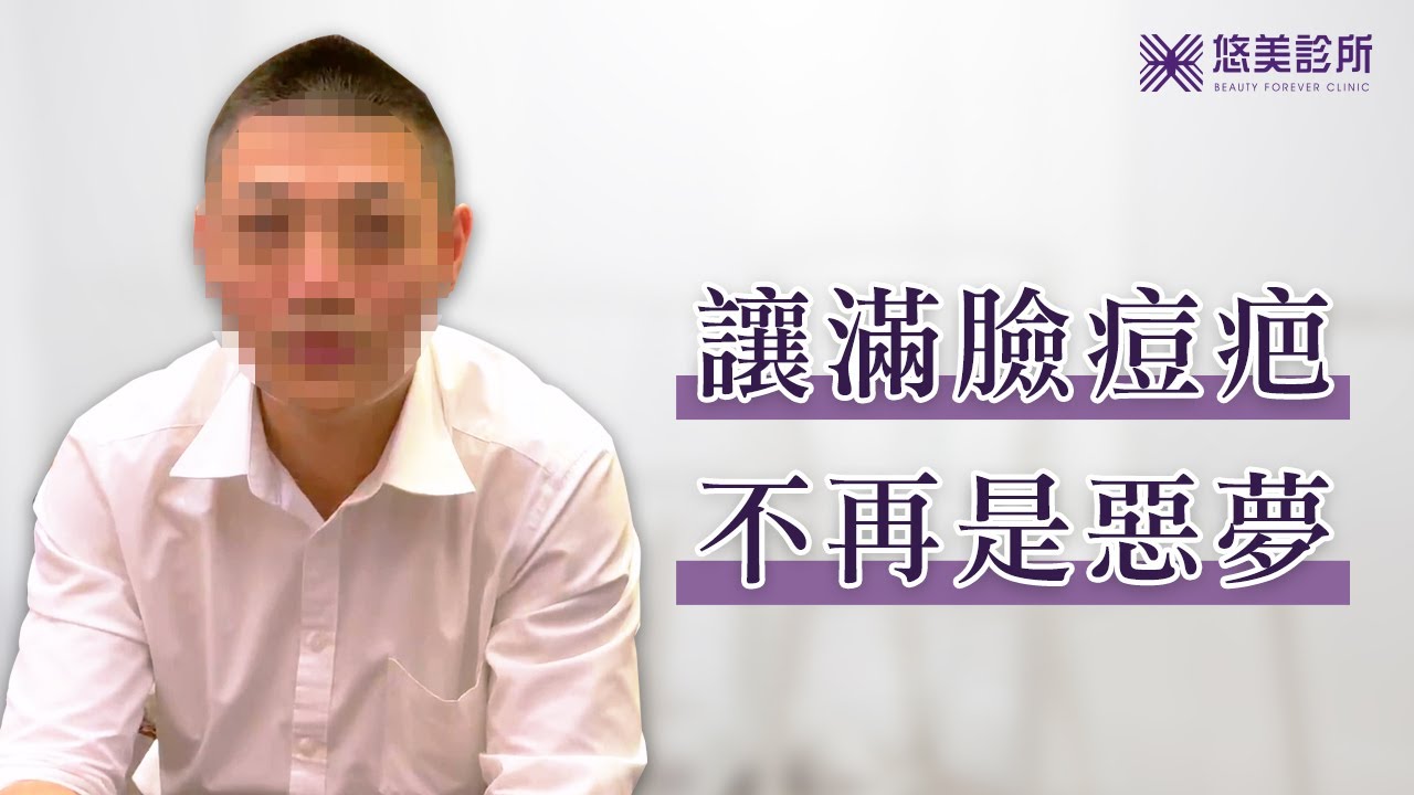 痘疤治療 UP雷射療程要多久？會痛嗎？｜悠美診所