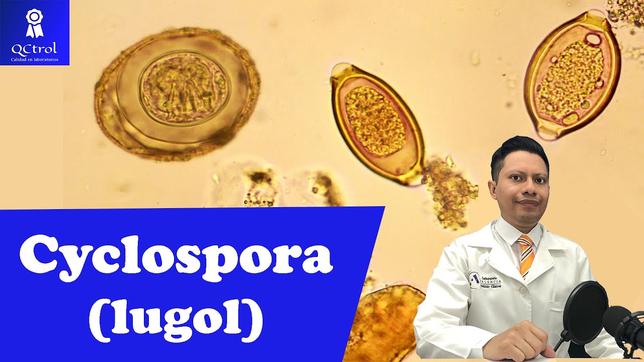 Знакомьтесь: Cyclospora cayetanensis: МОРФОЛОГИЯ и КЛЮЧИ для ее идентификации.