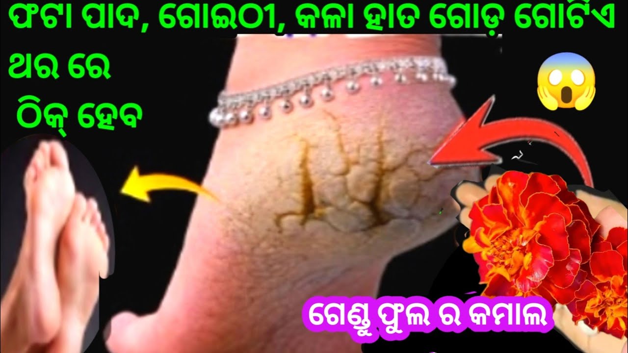 କେବଳ ଗୋଟିଏ ଥର ରେ ଭଲହେବ ଫଟା ପାଦ ଗୋଇଠୀ ଏବଂ ଆଣ୍ଠୁ ଗଣ୍ଠି ଦରଜ😱ଏହି ଶିକ୍ରେଟ୍ ଉପାୟ ରେ।odia kitchentips।crack